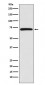 Anti-BIRC2 Monoclonal Antibody